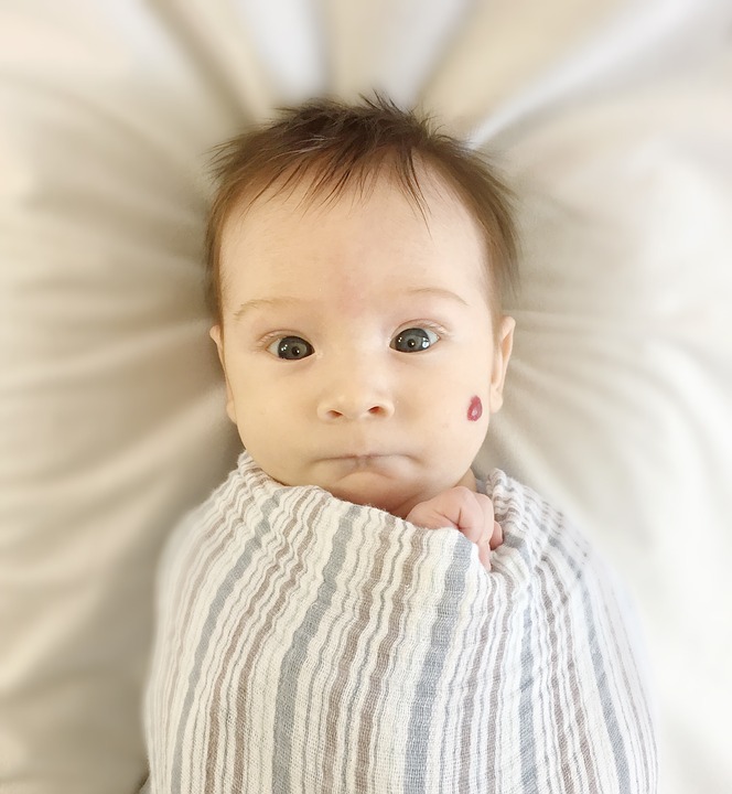 Newborn, Baby, Swaddle, Hemangioma